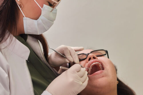 ¿Cada cuánto tiempo debes hacerte una limpieza dental?